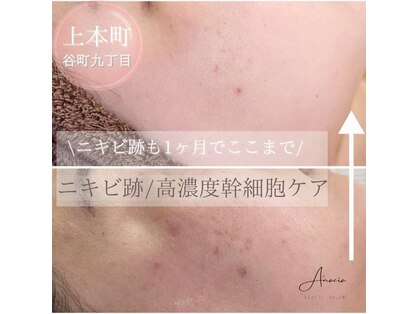 アナシアビューティーサロン(Anacia)の写真