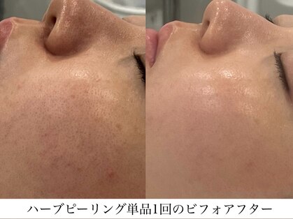 トム(Thom)の写真