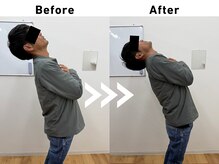 てあつい整体院 下松院/腰痛