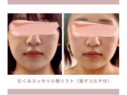 ロジワール(LOISIR)の写真