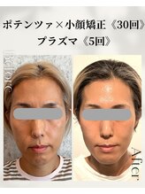 ネイルアンドアンチエイジングドゥシール(Docile)/40代女性｜たるみ・ハリツヤ改善