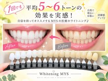 ホワイトニングミース 北千住店(MYS)の雰囲気（1回で平均5～6トーンUP！速攻で理想の白さを実感）