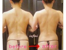 アンフィニ(infini)/短期集中全身8回コース（3ヶ月）
