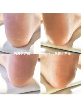 ニコプラス(NICO+)/足裏角質除去