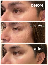 リア(lia)/ゾンビパックはオプションに◎