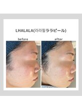 ポムハヌル 大阪梅田中崎町(pom.haneul)/韓国肌管理室