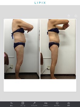 健康痩身研究所 蟹江店/ビフォーアフター