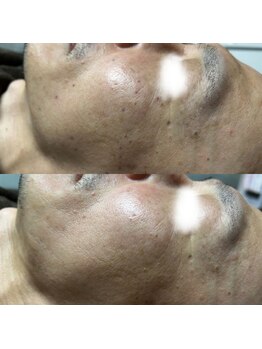 ルミナ シブヤ(LUMINA SHIBUYA)/Before→After