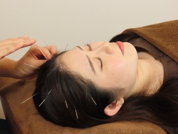 ジネコラボ 新橋汐留店(Gyneco-labo)/疲れを癒したい方に人気☆頭皮鍼
