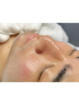 メンズフェイシャル