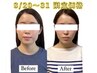 8/20～31限定【圧倒的小顔人気No.1】美容鍼×小顔矯正スペシャル¥16,500