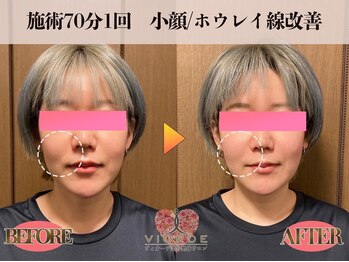 ヴィオーデ 徳島店/小顔、リンパ、ヘッドスパ、整体