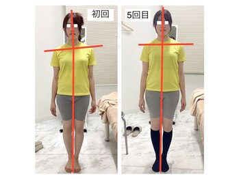 シンメトリー 千葉店/首肩コリ・巻き肩・肩甲骨周りも