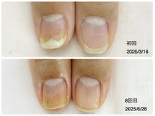 キアラネイル(Chiala nail)/自爪育成