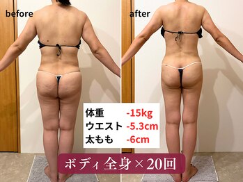 クレンズ(CLeanse)/40代女性ボディ全身105分×20回