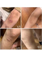 ヴィヴ コレビ(VIV COREBI)/悩み改善