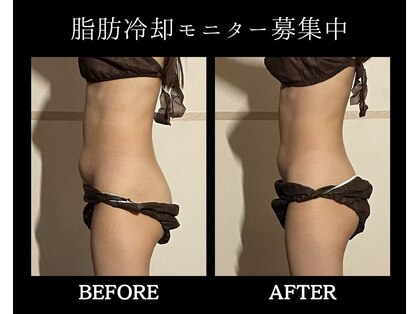 ブルースター(Blue Star)の写真