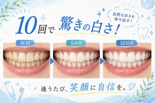 ホワイトニングショップ 香川丸亀店