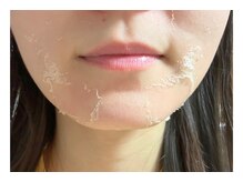 モネ(monet)/グリーンピール　脱皮