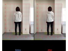 けいのき鍼灸整骨院/姿勢から身体を楽に!整体/肩こり