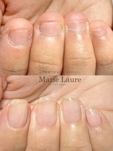 マリーロール 淀屋橋本店(Marie Laure)/自爪育成/深爪矯正/ネイルケア