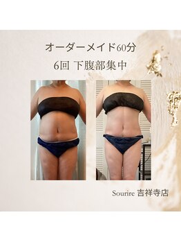 スリール 吉祥寺店(Sourire)/60代お腹集中