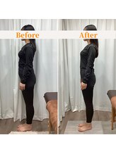 ルーム(Looom)/Before After