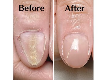 スマイルニコ(smile nico)