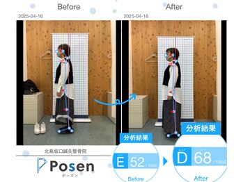 北島坂口鍼灸整骨院/ビフォー、アフター