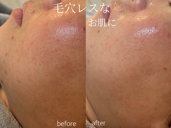 シェア(share.)/毛穴レスなお肌に◎