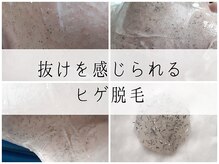 コチカ 恵比寿(KOCKA)/やることやれば高効果◆◇脱毛