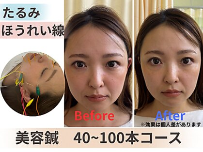 りゅうた整骨院 鍼灸院 宝塚中山寺店の写真