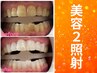 【会員/回数券】8分×2回美容セルフホワイトニング