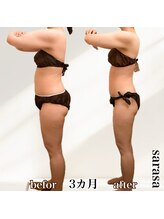 ナチュラル ビューティー スタイル さらさ(Natural Beauty Style)/さらさ痩身プログラム3カ月