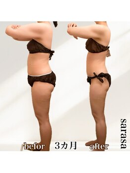 ナチュラル ビューティー スタイル さらさ(Natural Beauty Style)/さらさ痩身プログラム3カ月