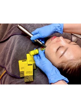 ホウレイ線・たるみ改善！予防ケア