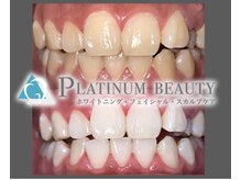 プラチナムビューティー 川口駅前店(PLATINUM BEAUTY)/医療と同じクオリティ