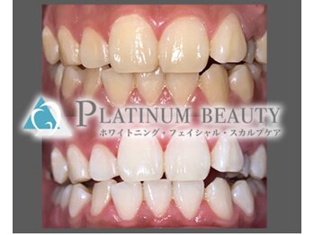プラチナムビューティー 川口駅前店(PLATINUM BEAUTY)/医療と同じクオリティ