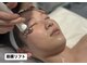 ハリシェンドの写真/『美容医療は気になるけど、高額だしダウンタイムも怖い』美容鍼は表情が硬くならず自然にリフトアップ