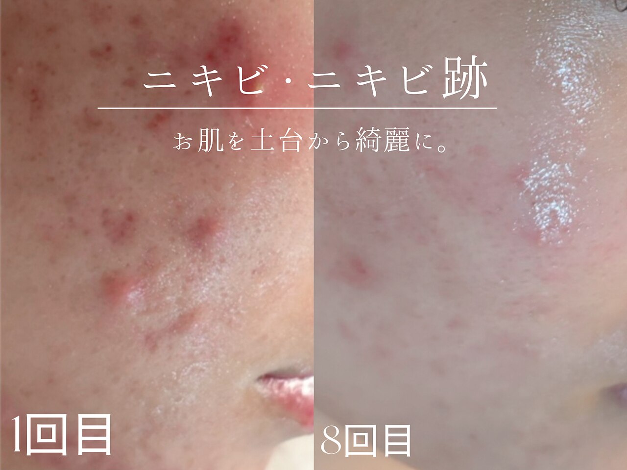 ウィハナ(wehana)｜ホットペッパービューティー