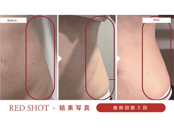 アロマフラワー神楽坂(Aroma Flower)の写真/脂肪にアプローチ、美しいくびれへ!リバウンドしにくい理想のボディへ導きます♪