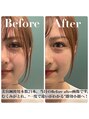 ナノフェイス 名古屋駅前店(nano face)/nano.face　ナノ.フェイス
