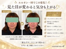 ヨサパーク フォルカ シンカケイヨモギムシ シンブリンパマッサージ(YOSA PARK folka)の雰囲気（むくみがとれてお顔がスッキリしました）