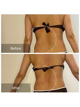 ウィズ ユー ビューティ(with U beauty)/厚みが違いますね