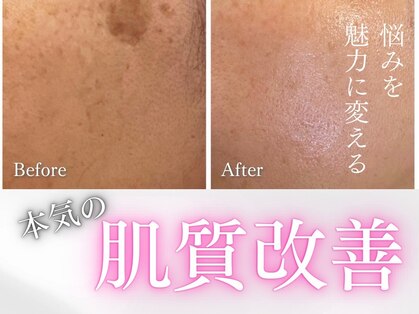 ワールドアイ(World. I)の写真