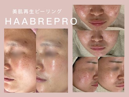 マシェリ(macherie)の写真