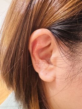 ベルフルール 浜松中野町店/耳つぼ/痩身