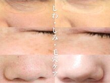 リラクゼーションエステハウス リンレイ(RINREI)