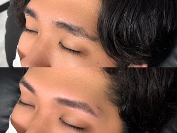 イブ(Eve)/ビフォーアフター