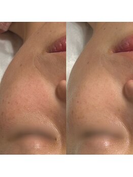 シーラックス(Sealax)/左before/右after